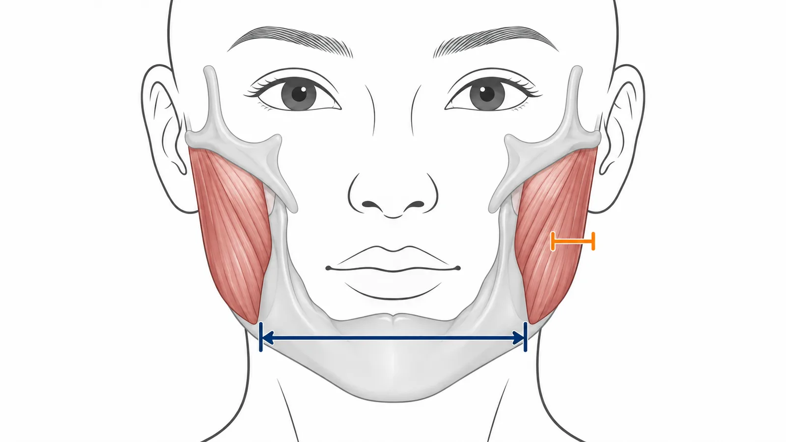 정면 얼굴 선화 안에 회색 아래턱뼈와 광대뼈, 양쪽 턱 옆의 붉은 교근을 그리고 오른쪽 교근 두께에 주황 괄호, 양쪽 턱각 사이에 남색 양방향 화살표를 그린 글자 없는 교육 그림이다.